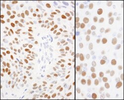 MCM2, p Ser108 Antibody, Novus Biologicals 0.1mg; Unlabeled:Antibodies,